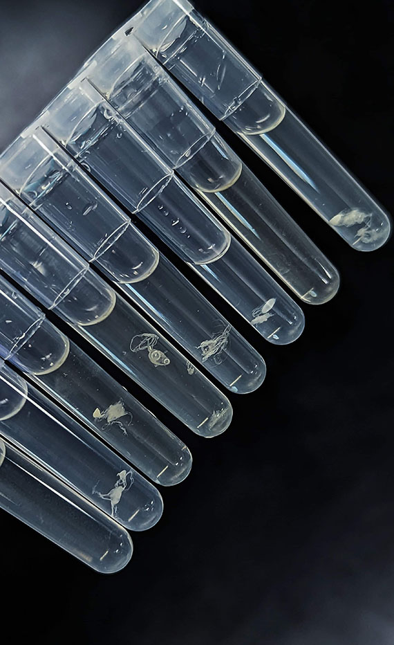 8 different test tube samples of DNA floating in transparent liquid. 